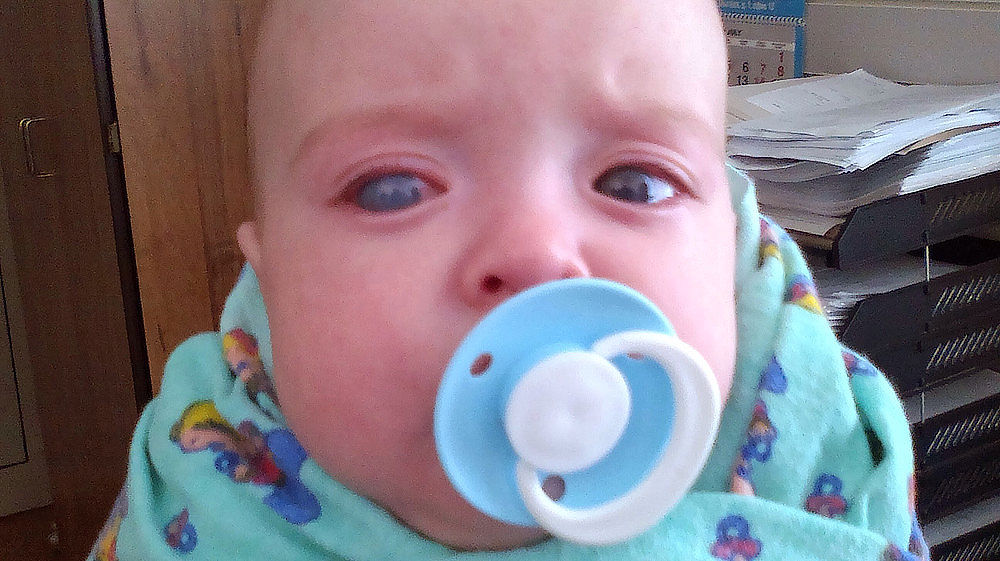 Miminko s vrozeným glaukomem. 